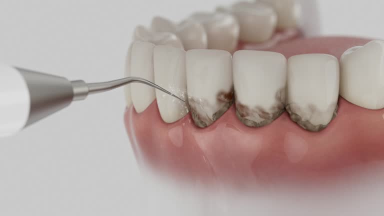 Reliable Dental contractor in Forsyth, MO by Dentist Open Now